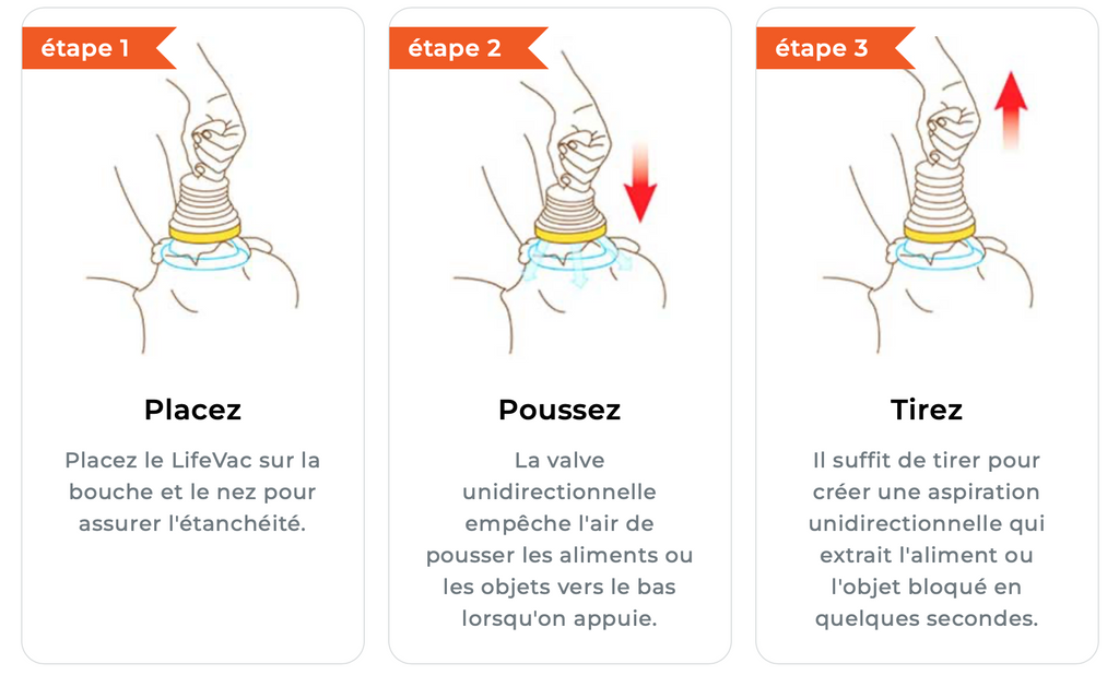 Fonctionnement du dispositif LifeVac en trois étapes pour dégager les voies respiratoires