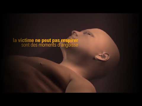 Démonstration vidéo du dispositif LifeVac en cas d’étouffement chez l’enfant